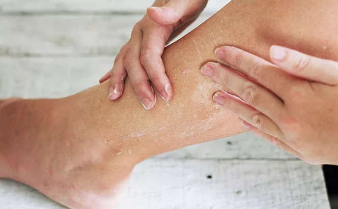 Как ухаживать за сухой кожей ног?